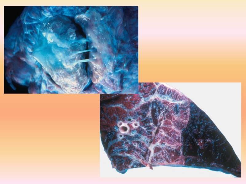 плевропневмония 1.jpg